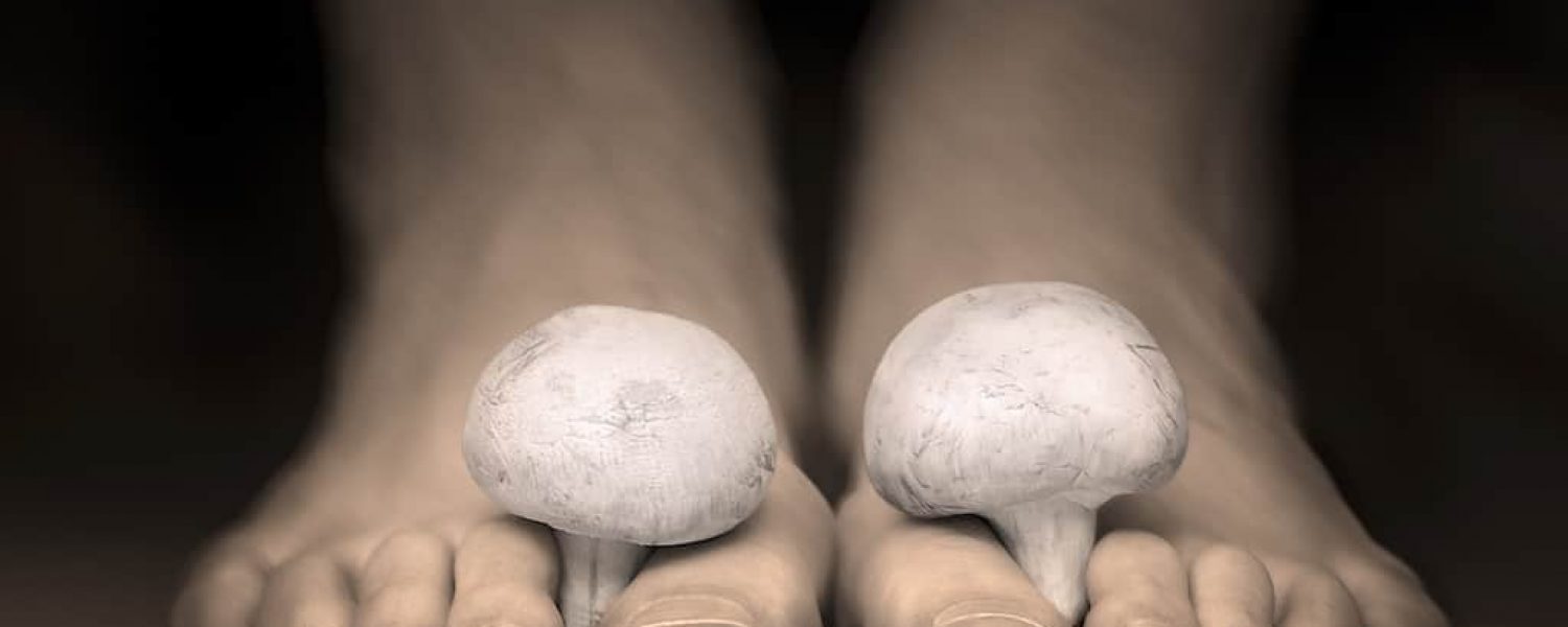 Nagelpilz Füße mit echtem Pilz